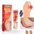 BONION CREMA PARA ALIVIO DE JUANETES